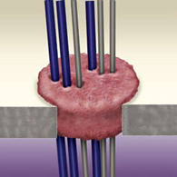 Fp200 expanding foam